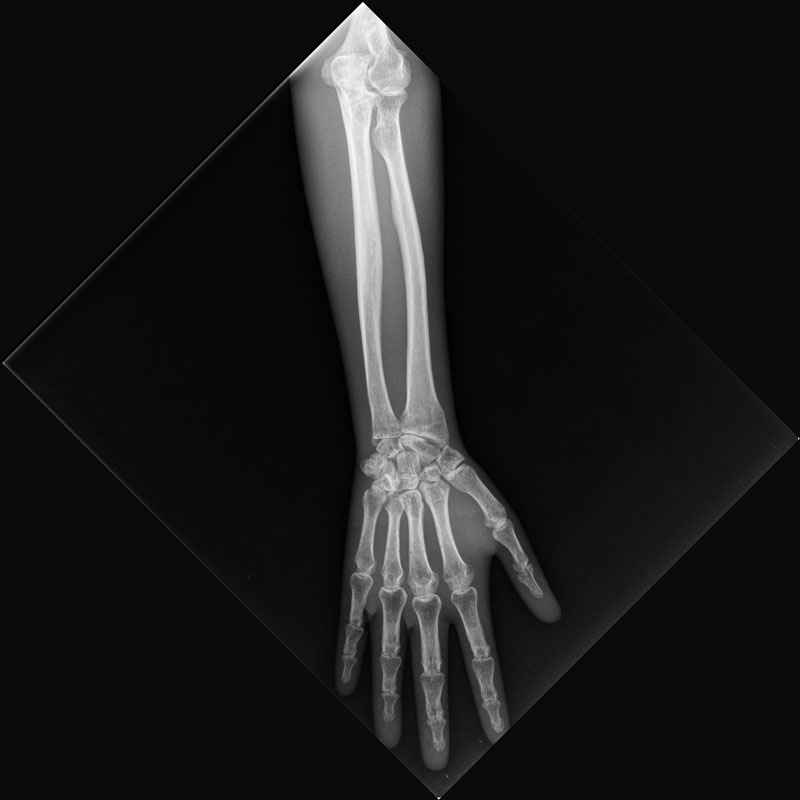 Partial X-ray phantoms