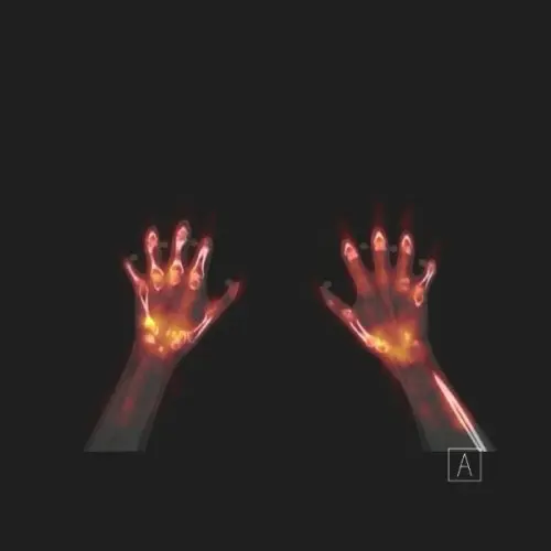 Hand Support